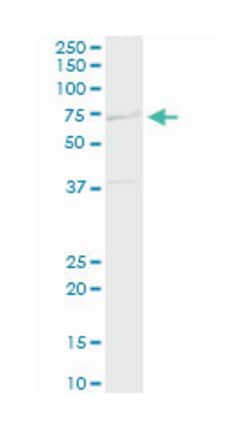 RHOBTB3, Mouse, Polyclonal Antibody, Abnova 50 &mu;L | Buy Online | Abnova Corporation | Fisher Scientific