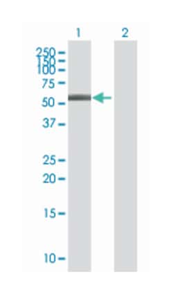 actin binding LIM protein family, member 3, Mouse, Polyclonal Antibody,
