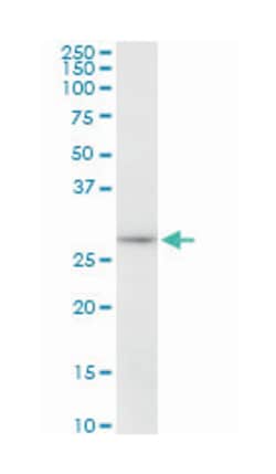 microtubule-associated protein, RP/EB family, member 1, Mouse, Polyclonal