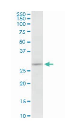 microtubule-associated protein, RP/EB family, member 1, Mouse, Polyclonal