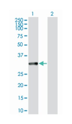 microtubule-associated protein, RP/EB family, member 1, Mouse, Polyclonal