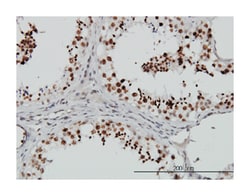 SMG1 homolog, phosphatidylinositol 3-kinase-related kinase (C. elegans),