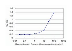 SMG1 homolog, phosphatidylinositol 3-kinase-related kinase (C. elegans),