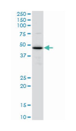 thioredoxin domain containing 4 (endoplasmic reticulum), Mouse, Clone: