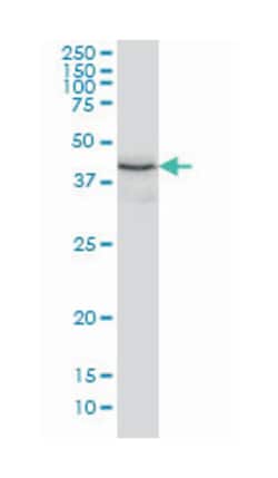 thioredoxin domain containing 4 (endoplasmic reticulum), Mouse, Clone: