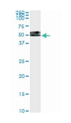thioredoxin domain containing 4 (endoplasmic reticulum), Mouse, Clone: