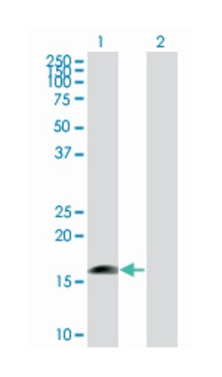 mitochondrial ribosomal protein S27, Mouse, Polyclonal Antibody, Abnova