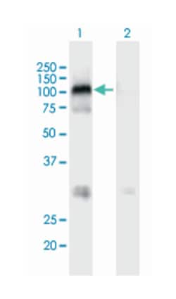 MAST2, Mouse, Polyclonal Antibody, Abnova 50&mu;L; Unlabeled:Antibodies,