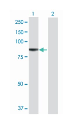 Rtf1, Paf1/RNA polymerase II complex component, homolog (S. cerevisiae),