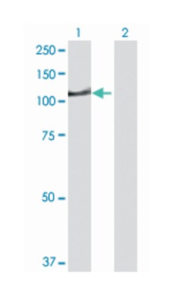 DIP2 disco-interacting protein 2 homolog A (Drosophila), Rabbit, Purified