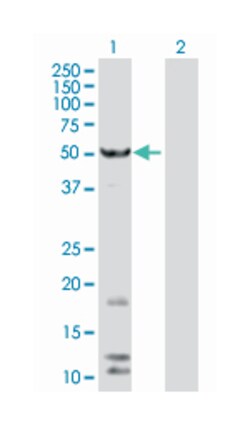 Fas associated factor family member 2, Mouse, Polyclonal Antibody, Abnova 50 &mu;L | Buy Online | Abnova | Fisher Scientific