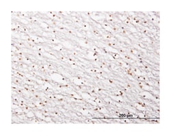 sirtuin (silent mating type information regulation 2 homolog) 1 (S. cerevisiae),