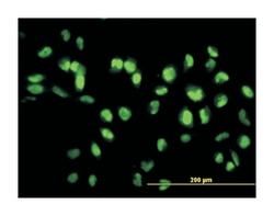 sirtuin (silent mating type information regulation 2 homolog) 1 (S. cerevisiae),