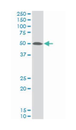 TAR DNA binding protein, Mouse, Polyclonal Antibody, Abnova 50&mu;L; Unlabeled:Antibodies,