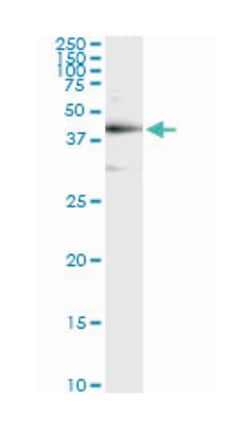 TAR DNA binding protein, Mouse, Clone: 2E2-D3, Abnova 100 &mu;g | Buy Online | Abnova Corporation | Fisher Scientific
