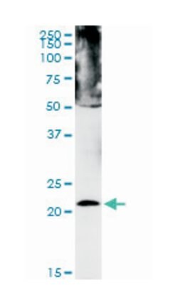 chromobox homolog 5 (HP1 alpha homolog, Drosophila), Mouse, Polyclonal