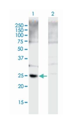 chromobox homolog 5 (HP1 alpha homolog, Drosophila), Mouse, Polyclonal