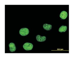 chromobox homolog 5 (HP1 alpha homolog, Drosophila), Mouse, Polyclonal