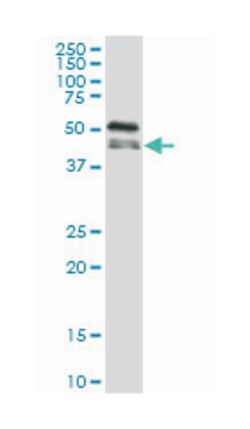 RNA binding motif protein 9, Mouse, Clone: 5E11, Abnova 100&mu;g; Unlabeled:Antibodies,