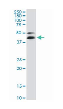 RNA binding motif protein 9, Mouse, Clone: 5E11, Abnova 100&mu;g; Unlabeled:Antibodies,