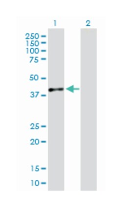 dimethylarginine dimethylaminohydrolase 1, Mouse, Purified MaxPab Polyclonal Antibody, Abnova 50 &mu;g | Buy Online | Abnova | Fisher Scientific