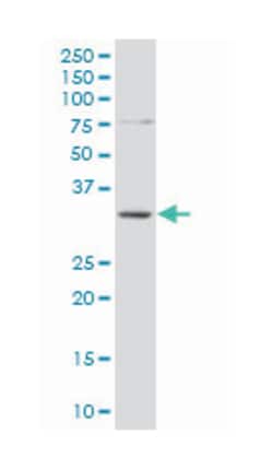 single-strand-selective monofunctional uracil-DNA glycosylase 1, Mouse, Polyclonal Antibody, Abnova 50 &mu;L | Buy Online | Abnova Corporation | Fisher Scientific