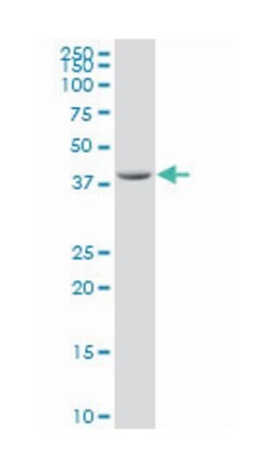 SPO11 meiotic protein covalently bound to DSB homolog (S. cerevisiae), Mouse, Polyclonal Antibody, Abnova&trade;