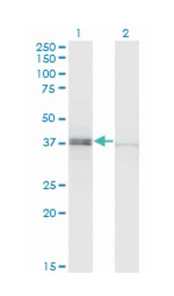 SPO11 meiotic protein covalently bound to DSB homolog (S. cerevisiae), Mouse, Polyclonal Antibody, Abnova&trade;