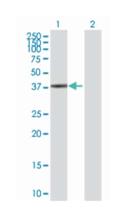 SPO11 meiotic protein covalently bound to DSB homolog (S. cerevisiae),