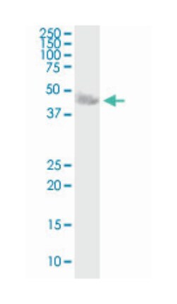 carbonic anhydrase XIV, Mouse, Purified MaxPab Polyclonal Antibody, Abnova 50 &mu;g | Buy Online | Abnova Corporation | Fisher Scientific