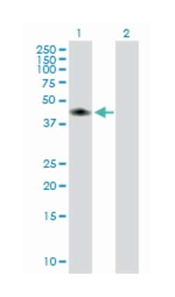 carbonic anhydrase XIV, Mouse, Purified MaxPab Polyclonal Antibody, Abnova 50 &mu;g | Buy Online | Abnova Corporation | Fisher Scientific