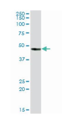 carbonic anhydrase XIV, Mouse, Purified MaxPab Polyclonal Antibody, Abnova 50 &mu;g | Buy Online | Abnova Corporation | Fisher Scientific
