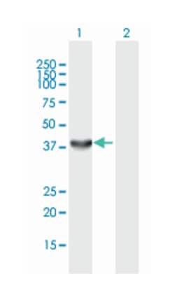 HSPA (heat shock 70kDa) binding protein, cytoplasmic cochaperone 1, Mouse,