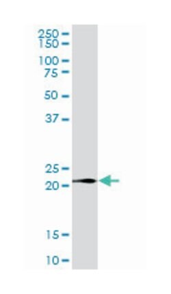 LY96 (B03P), Mouse anti-Human, Polyclonal Antibody, Abnova 50&mu;g; Unlabeled:Antibodies,