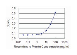 PLXNB2, Mouse, Clone: 2H3, Abnova 100 &mu;g | Buy Online | Abnova Corporation | Fisher Scientific