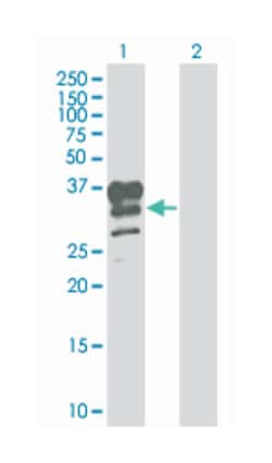 N-acetyltransferase 6 (GCN5-related) (B01), Mouse anti-Human, Polyclonal