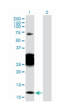 chibby homolog 1 (Drosophila), Rabbit, Purified MaxPab Polyclonal Antibody,