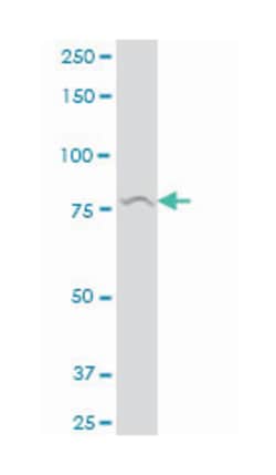 RAS guanyl releasing protein 3 (calcium and DAG-regulated), Mouse, Polyclonal Antibody, Abnova 50 &mu;L | Buy Online | Abnova Corporation | Fisher Scientific