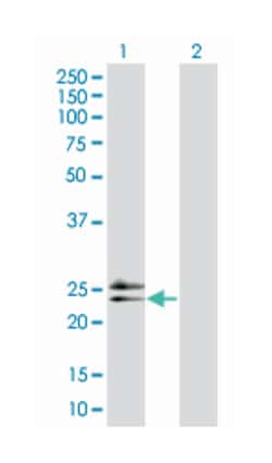 RAD54 homolog B (S. cerevisiae), Mouse, Polyclonal Antibody, Abnova 50&mu;L;