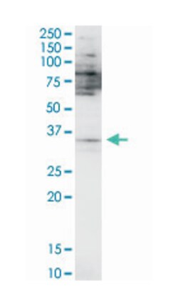 SPDEF, Mouse, Polyclonal Antibody, Abnova 50&mu;L; Unlabeled:Antibodies,