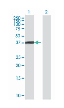 ventral anterior homeobox 2, Mouse, Polyclonal Antibody, Abnova 50&mu;L;