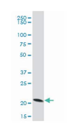 peroxiredoxin 5, Mouse, Polyclonal Antibody, Abnova 50&mu;L; Unlabeled:Antibodies,
