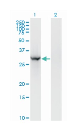breast cancer metastasis suppressor 1, Mouse, Clone: 2D4-2G11, Abnova 100&mu;g;
