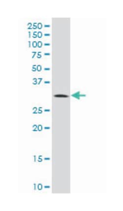 breast cancer metastasis suppressor 1, Mouse, Clone: 2D4-2G11, Abnova 100&mu;g;