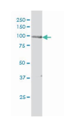 PRKD2, Mouse, Clone: 2E4, Abnova 200&mu;L; Unlabeled:Antibodies, Monoclonal