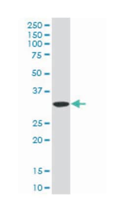 sulfatase modifying factor 2, Mouse, Polyclonal Antibody, Abnova 50&mu;L;