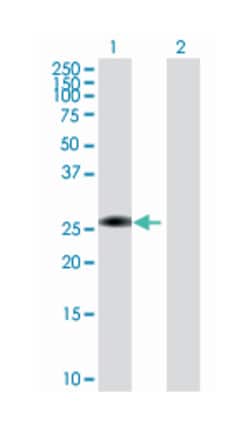 ring finger and CHY zinc finger domain containing 1, Mouse, Polyclonal