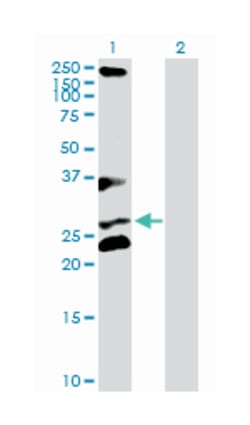 ring finger and CHY zinc finger domain containing 1, Rabbit, Purified MaxPab