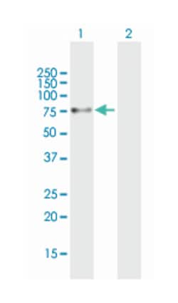protein phosphatase 1, regulatory (inhibitor) subunit 16B, Mouse, Purified