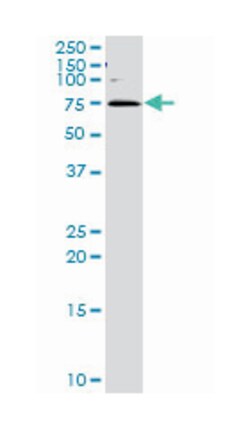 golgi associated, gamma adaptin ear containing, ARF binding protein 1,